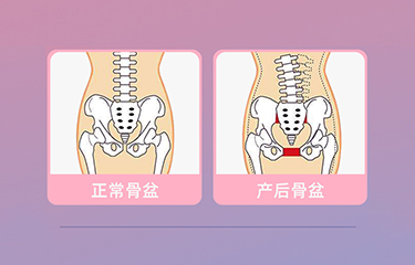 盆底肌修復儀器怎么樣？哪些人可以使用它呢