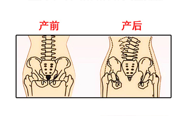 月子期間盆骨儀器修復(fù)時(shí)間有限制嗎？與手法修復(fù)相比哪個(gè)效果好？